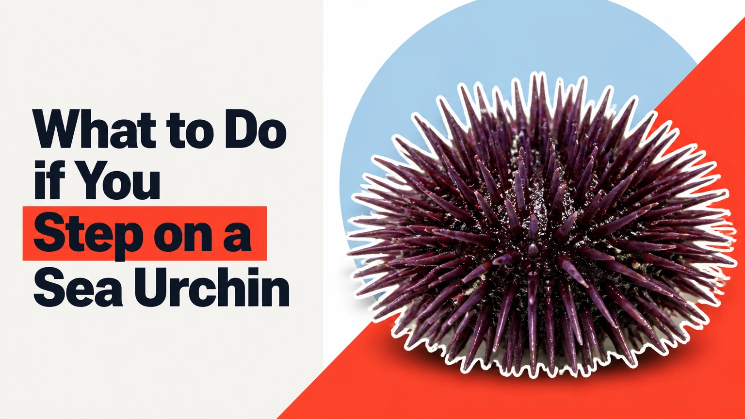 what to do if you step on a sea urchin
